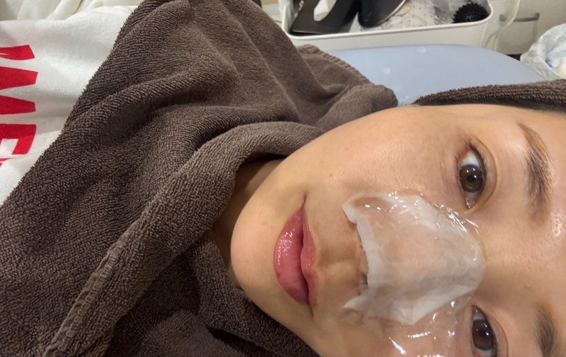 娘に言われ気にしているママの毛穴の画像