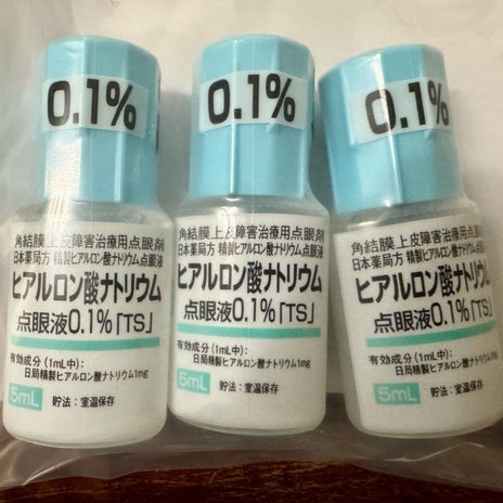 花粉症で瞼が腫れて変わった顔の画像