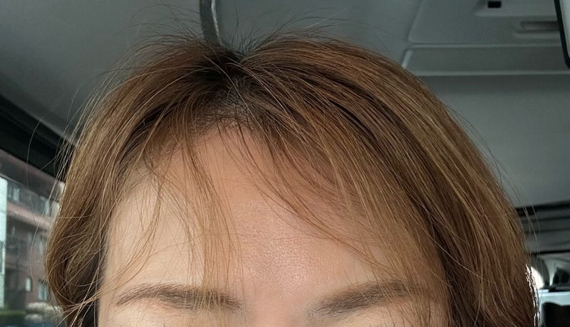 遠藤の妻 薄くなった前髪の原因の画像